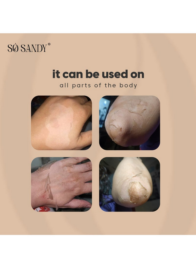 Mela Off Cream Cold Peel 5 gm - (one session)