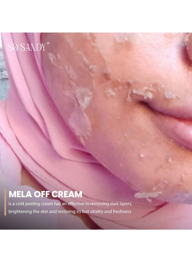 Mela Off Cream Cold Peel 5 gm - (one session)