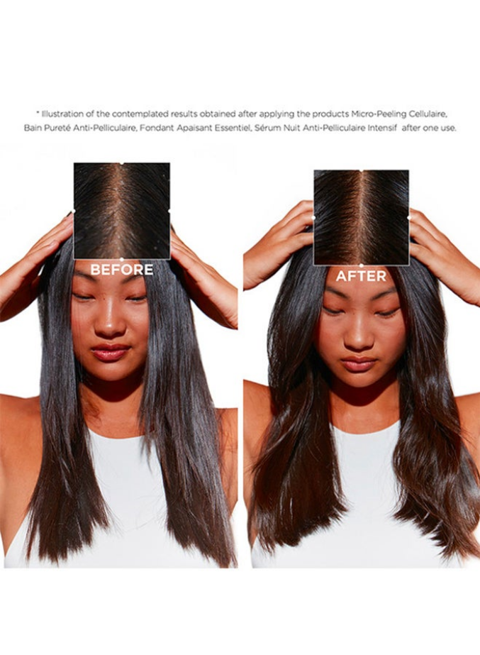 Symbiose Purifying Anti-Dandruff Cellular Shampoo,